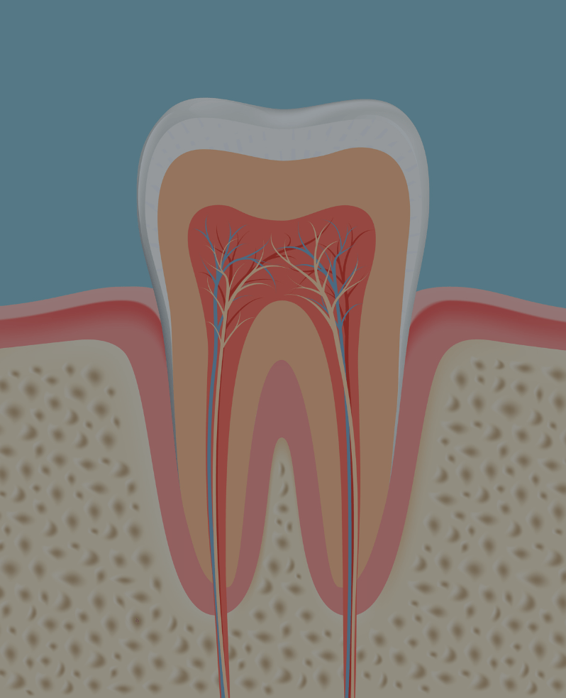 Treatment - Buttercross Dental Practice