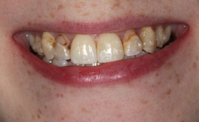 Before - Buttercross Dental Practice