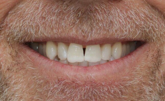 Before - Buttercross Dental Practice