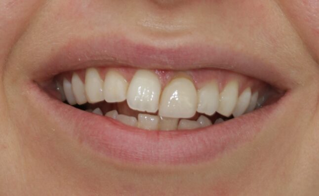 Before - Buttercross Dental Practice